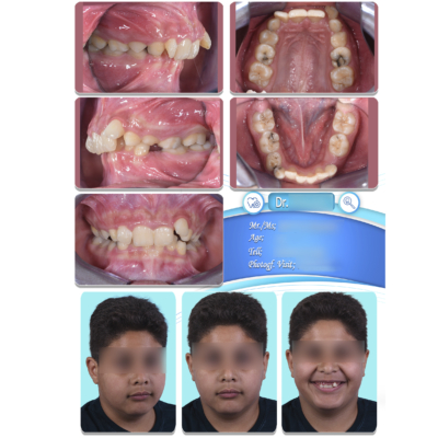 نمونه فتوگرافی ارتودنسی